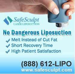 Safesculpt Laser Liposuction