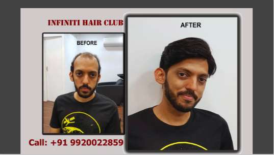 Infiniti Hair Club 