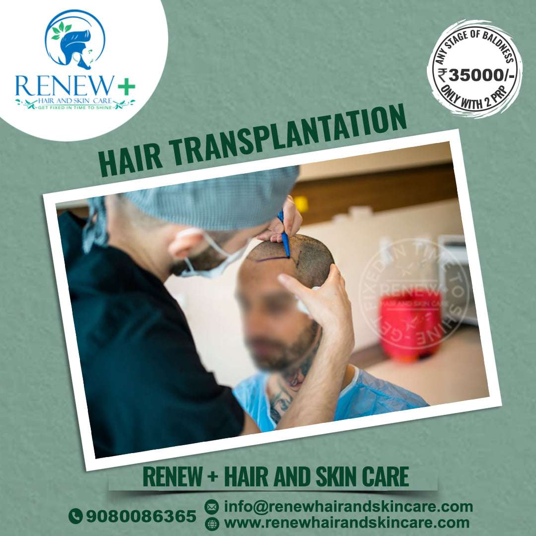 Renew Hair Clinic
